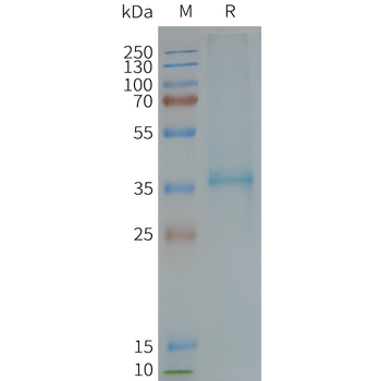 Human XCR1 full length protein-synthetic nanodisc