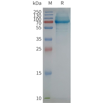 Human SCARB1 full length protein-synthetic nanodisc