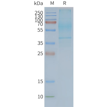 Human GPR20 full length protein-synthetic nanodisc