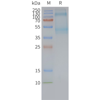 Human ADGRG2 full length protein-synthetic nanodisc