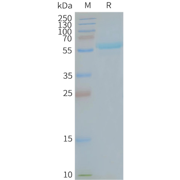 Human MFSD13A full length protein-synthetic nanodisc