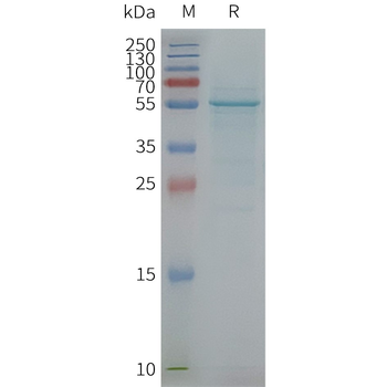 Human TMCC3 full length protein-synthetic nanodisc