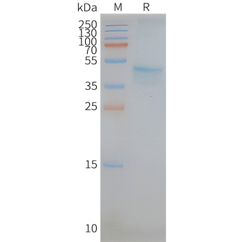 Human CCR5 full length protein-synthetic nanodisc