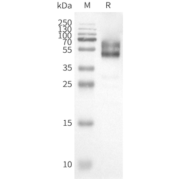 Human HCRTR1 full length protein-synthetic nanodisc