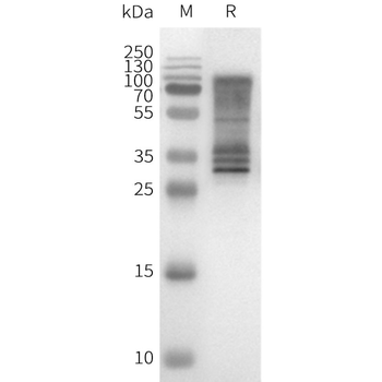 Human GNRHR full length protein-synthetic nanodisc