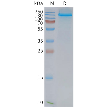 Human NPC1L1 full length protein-synthetic nanodisc