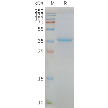 Human MLC1 full length protein-synthetic nanodisc