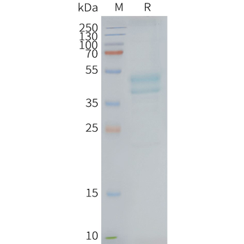 Human C5AR1 full length protein-synthetic nanodisc