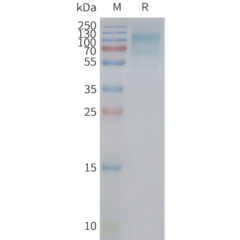Human SLC2A12 full length protein-synthetic nanodisc
