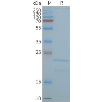 Human CLDN2 full length protein-synthetic nanodisc