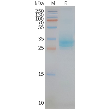 Human CD151 full length protein-synthetic nanodisc