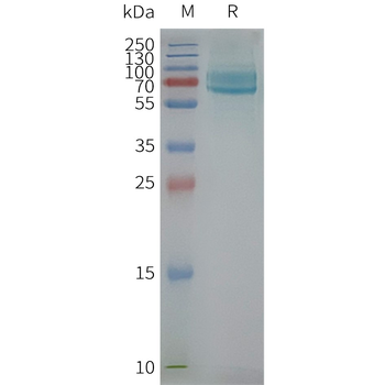 Human CD39 full length protein-synthetic nanodisc