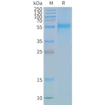 Human CCR9 full length protein-synthetic nanodisc