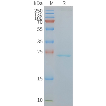 Human CMTM6 full length protein-synthetic nanodisc