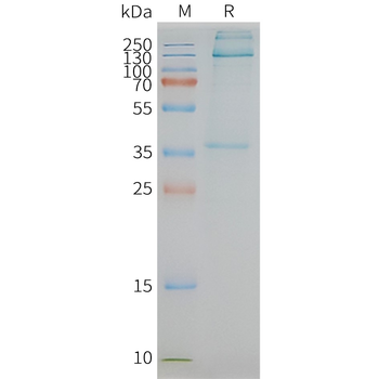 Human ADGRE1 full length protein-synthetic nanodisc