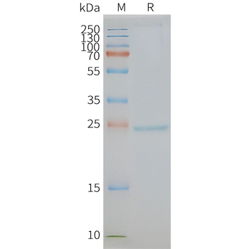 Human CD81 full length protein-synthetic nanodisc
