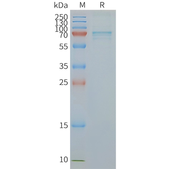 Human P2RX7 full length protein-synthetic nanodisc