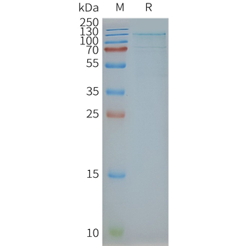 Human TSHR full length protein-synthetic nanodisc