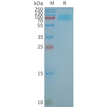 Human CD36 full length protein-synthetic nanodisc