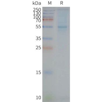 Human STEAP2 full length protein-synthetic nanodisc
