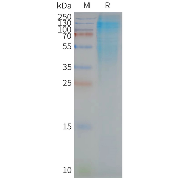 Human CD37 full length protein-synthetic nanodisc