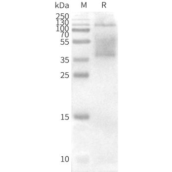 Human CD37 full length protein-synthetic nanodisc