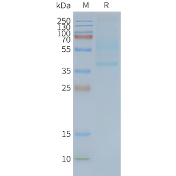 Human CD47 full length protein-synthetic nanodisc
