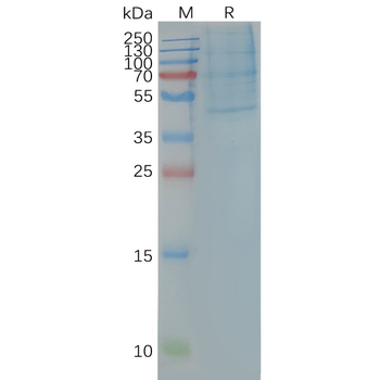 Human CCR4 full length protein-synthetic nanodisc