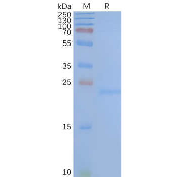 Human TM4SF1 full length protein-synthetic nanodisc