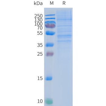 Human CCR2 full length protein-synthetic nanodisc