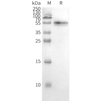 Human CCR2 full length protein-synthetic nanodisc
