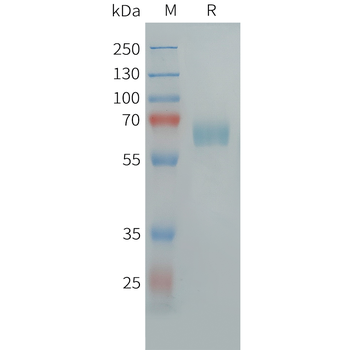 Cynomolgus IL18BP Protein, His Tag