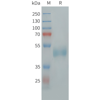 Cynomolgus CLEC4C Protein, His Tag