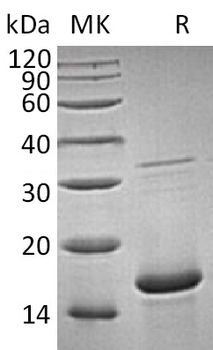 Human IBSP Protein, His Tag