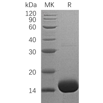 Human S100A9 Protein, hFc Tag