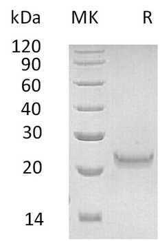 Human DSG2(24-609) Protein, His Tag