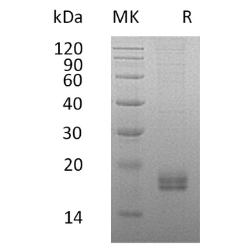 Human DSG2(50-609) Protein, His Tag