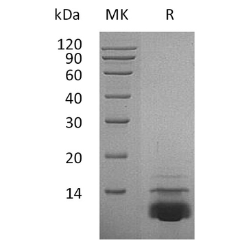 Human PTGFRN Protein, His Tag
