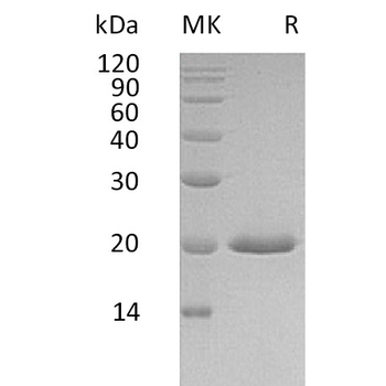Human CHRM2 Protein, hFc Tag