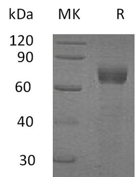 Human PF4V1 Protein, hFc Tag
