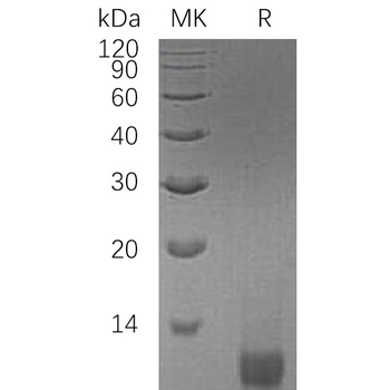 Human ECSCR Protein, hFc Tag