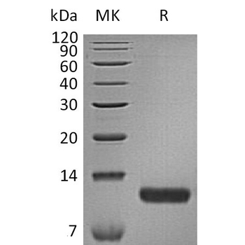 Human CPM Protein, His Tag