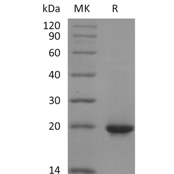Human GPR20 Protein, hFc Tag
