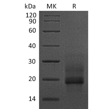 Human TMEM219 Protein, hFc Tag