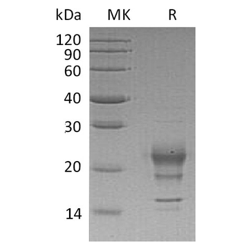 Human GIPR Protein, hFc Tag