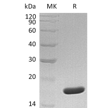 Human LRRN1 Protein, His Tag