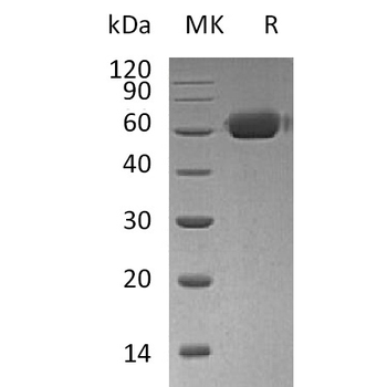 Human FCRL2 Protein, His Tag