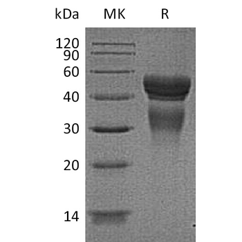 Human IL23R Protein, His Tag