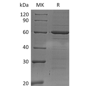 Human IL19 Protein, hFc Tag
