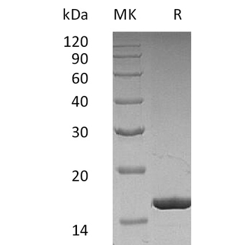 Human ACVRL1 Protein, hFc Tag